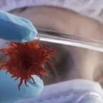 【文獻(xiàn)精度】蛋白組+三代全長轉(zhuǎn)錄組致力于腫瘤標(biāo)志物的研究